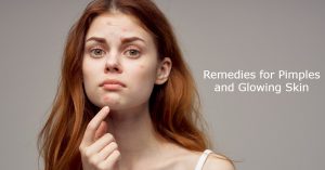 Remedies for Pimples and Glowing Skin